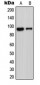 Anti-ADAM23 Antibody