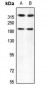 Anti-Kalirin Antibody