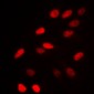 Anti-NCOR1 Antibody