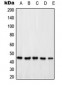 Anti-PSMD6 Antibody