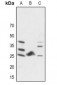 Anti-FGF19 Antibody