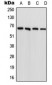 Anti-FARSB Antibody