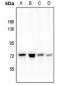 Anti-PAK4 (pS474) Antibody