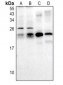 Anti-RAB30 Antibody