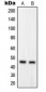 Anti-GPRC5B Antibody