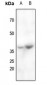 Anti-CABP4 Antibody