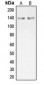 Anti-Collagen 20 alpha 1 Antibody