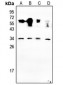 Anti-NRSN2 Antibody