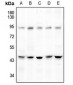 Anti-DGAT2 Antibody