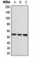 Anti-CLEC14A Antibody