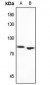 Anti-MEKK2 Antibody