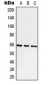 Anti-ATE1 Antibody