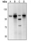 Anti-BET Antibody