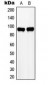 Anti-ZHX2 Antibody