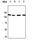 Anti-PALLD Antibody