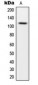 Anti-CARD14 Antibody