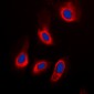 Anti-ADPGK Antibody