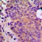 Anti-ADPGK Antibody