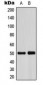 Anti-ADPGK Antibody