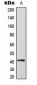 Anti-CEP41 Antibody