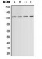 Anti-ACTN1/2/3/4 Antibody