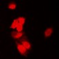 Anti-SIAH1/2 Antibody