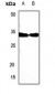 Anti-SIAH1/2 Antibody