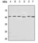 Anti-Beta-tubulin Antibody