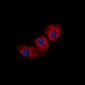 Anti-Cadherin 23 Antibody