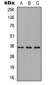 Anti-CD66c Antibody