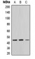 Anti-CTH Antibody