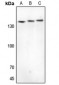 Anti-CYFIP1 Antibody