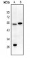 Anti-EPX HC Antibody