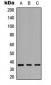 Anti-GPCR19 Antibody