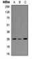 Anti-HOXC8 Antibody