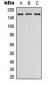 Anti-LPHN2 Antibody