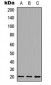 Anti-MID1IP1 Antibody