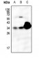 Anti-SFTPA1 Antibody