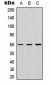 Anti-ZNF496 Antibody