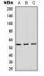 Anti-ADAMDEC1 Antibody