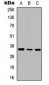Anti-Adenosine A2b Receptor Antibody