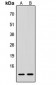 Anti-Procalcitonin Antibody