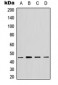 Anti-GTPBP5 Antibody