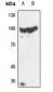 Anti-Histone Deacetylase 5/9 Antibody