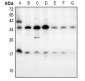 Anti-LY6E Antibody