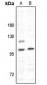 Anti-MYO1D Antibody