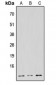 Anti-NDUFB1 Antibody
