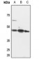 Anti-PINX1 Antibody