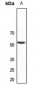 Anti-PLXDC1 Antibody