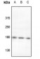 Anti-ROBO2 Antibody